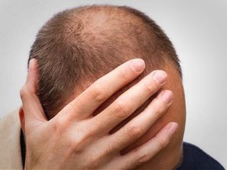 هفت راهکار موثر برای خلاصی از ریزش مو