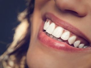با این روش ها به آسانی دندانهایتان را در خانه سفید کنید