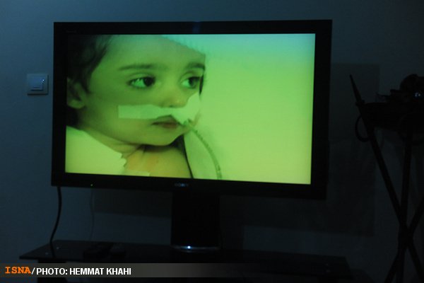 روژان کوچولو برای آینده بدون درد چشم انتظار کمک‌های مردمی 