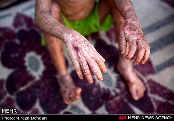 زندگی کابوس وار معصومه زندگی کابوس وار معصومه