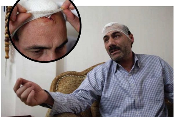 حمـله خونین نگهبان متـرو به​ مرد مسـافر