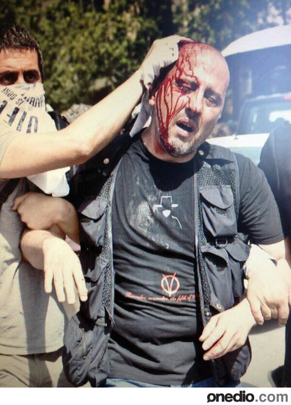 حمله خشونت‌آمیز پلیس استانبول به تظاهرکنندگان 2